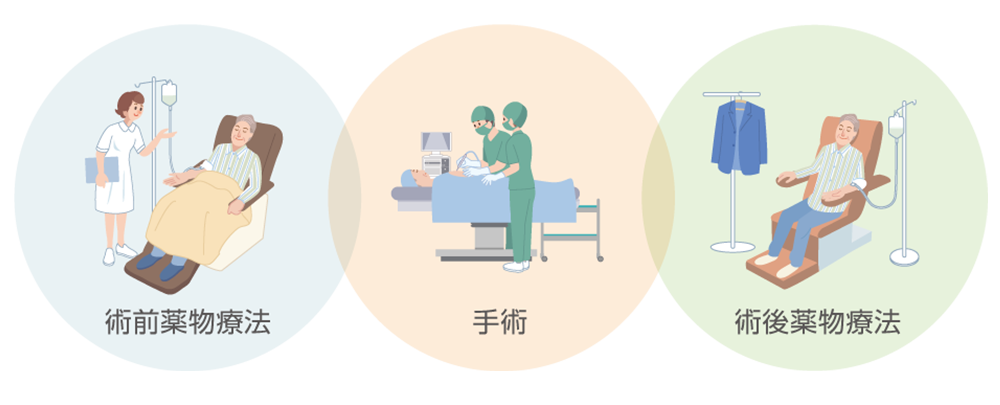 キイトルーダ®と化学療法併用による術前・術後薬物療法についてのイメージ